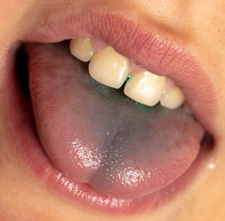 Close-up of a boy's blue tongue. Macroの写真素材
