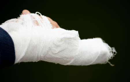 Broken arm in a cast in a boy. close-upの写真素材