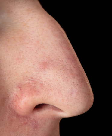 Long nose man isolated black background. Macro