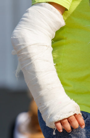 A person with a cast on their arm is wearing a green shirt. The cast is white and has a few frayed...