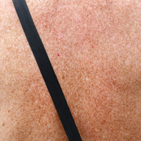A person's back with a black strap on it.