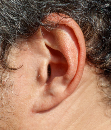 A man's ear is red and it is covered in hair