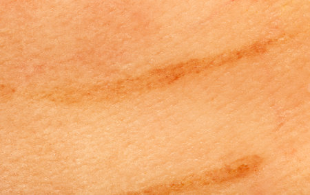 A tan skinned area with a brown line. The tan skin is slightly raised and the brown line is slightly raised as wellの写真素材