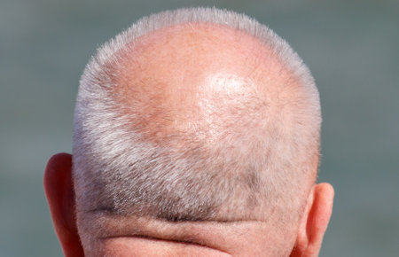A man with a head and a beard. The man is looking at the camera. The man's head has a beardの写真素材