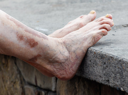A woman's foot is resting on a ledge. The foot is wrinkled and has a scarの写真素材