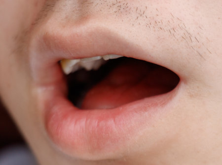 A man's mouth is open, revealing his teeth and gums. The teeth are yellow and the gums are red. The...