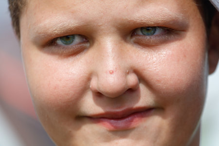 A young person with a green eye stares at the camera. He has a small scar on his noseの写真素材