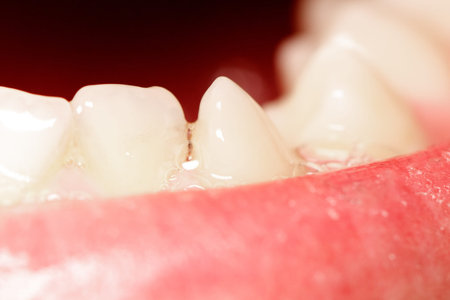 The inside of a person's mouth with teeth showing. The teeth are white and the gums are pink