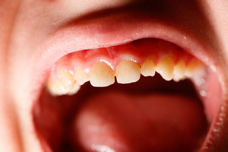 Teeth in a human mouth. Close-up.