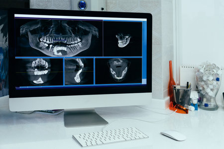 X ray image of a computer in a dentist's office.