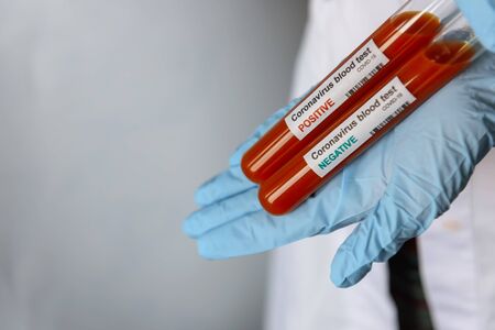 Scientist doctor holding test tubes with blood for covid-2019 analyzing. New coronavirus Covid 19 vaccine research. Novel coronavirus concept.の写真素材