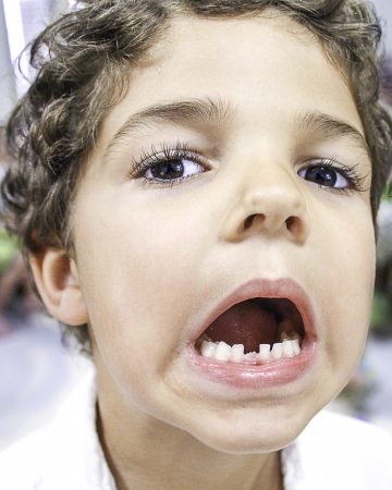 Portrait shot of a small child with mouth open showing off his lost tooth 
