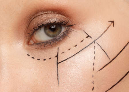 female eye area with perforation lines, platic surgery concept