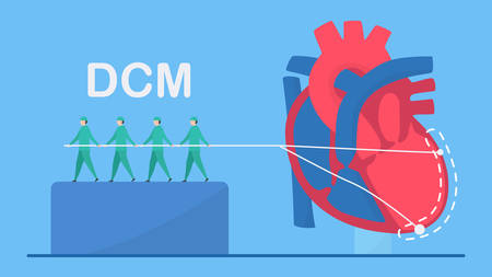 Cardiology  illustration. This diseases are HCM, DCM, and RCM. Ability of blood pumping is decreased. CM means cardiomyopathy. Diagnostic and analysis.のイラスト素材