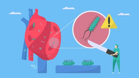 Cardiology treatment by surgeon. This disease calls endocarditis. It is infection of endocardium that is inner heart chambers and valves. Bacteria, parasite and virus are running to blood vessel.のイラスト素材