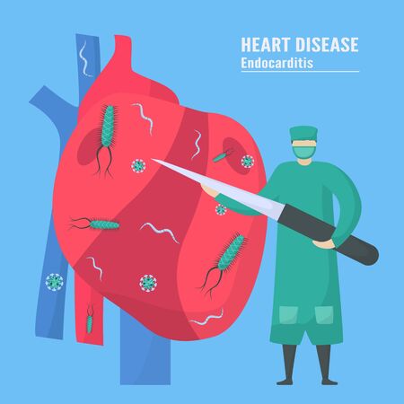 Cardiology treatment. This disease calls endocarditis. It is infection of endocardium that is inner heart chambers and valves. Bacteria, parasite and virus are running to blood vessel.のイラスト素材