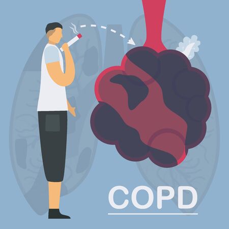 Smoking is cause of chronic obstructive pulmonary disease or COPD. Lung have breathing problems and poor airflow. Vector illustration in flat design.のイラスト素材