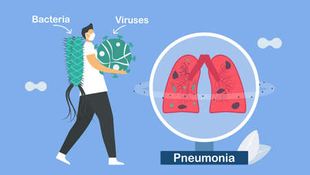 Pneumonia is infection that inflames air sacs in one or both lungs. This symptom is caused by bacteria and viruses. Pulmonology vector illustration about restrictive lung disease.のイラスト素材