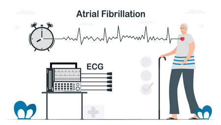 An electrocardiogram was used to analyse for atrial fibrillation problem. Cardiology vector illustration in flat style.のイラスト素材