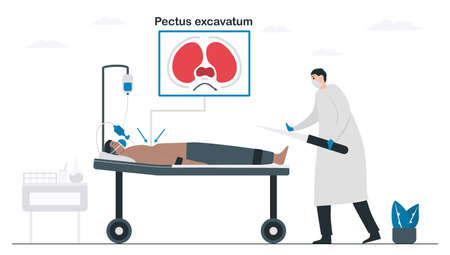 Doctors are operating a patient that is pectus excavatum. Pulmonology vector illustration about restrictive lung disease. Minimal design.のイラスト素材