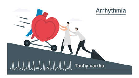 Doctor and medical assistant push heart that flows down quickly. This heart disease called tachycardia arrhythmia. Periodic signal is fast impulse response. Isolated cardiology vector illustration.のイラスト素材
