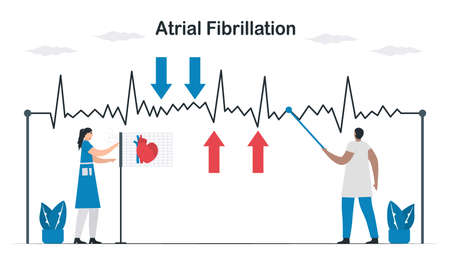 ECG signal of atrial fibrillation. Doctors check and analyze a heart disease. Cardiology vector illustration.のイラスト素材