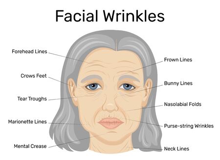 Illustration of types of wrinkles on the face of an old womanのイラスト素材