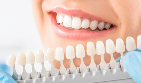 Beautiful smile and white teeth of a young woman. Matching the shades of the implants or the process of teeth whitening.の写真素材