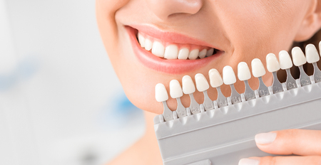 Beautiful smile and white teeth of a young woman. Matching the shades of the implants or the process of teeth whitening.の写真素材