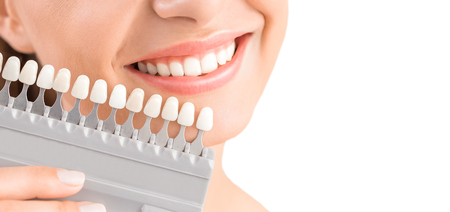 Beautiful smile and white teeth of a young woman. Matching the shades of the implants or the process of teeth whitening.の写真素材