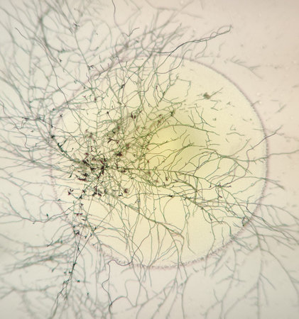Bacterial colony and mold under the microscope