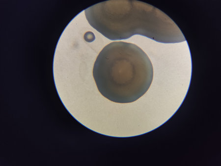 Bacterial colony under the microscope