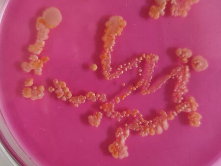 Staphylococcus aureus coloniesの写真素材