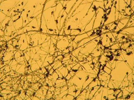 Dermatophyte fungus fungal mycelium