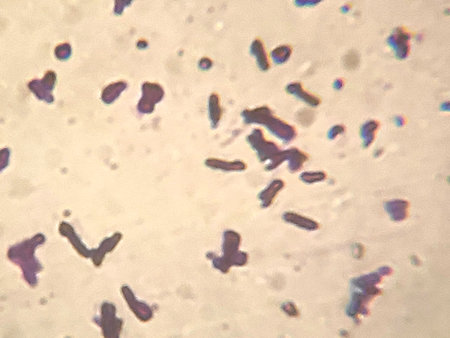 Escherichia coli under the microscope