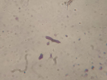 Escherichia coli under the microscope