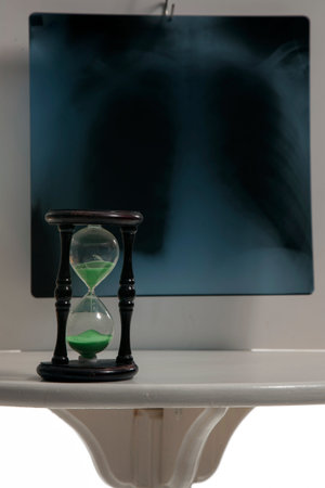 roentgen and an hourglass on white table