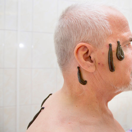 leech therapy for senior man