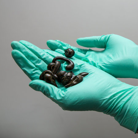 Medical leeches on the palms of the attending physician.