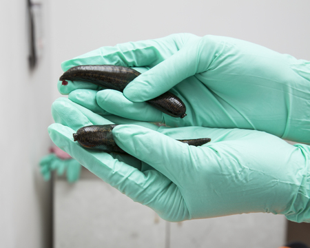 Medical leeches on the palms of the attending physician.の写真素材