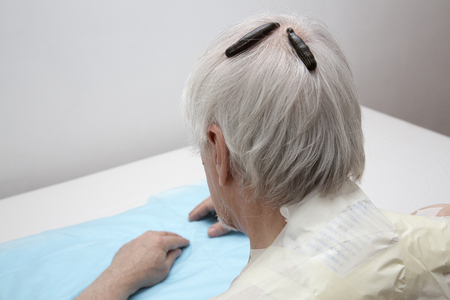 Treatment of headache, activity, dizziness, tinnitus medical leeches.の写真素材