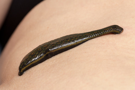 Leeches on his stomach in the liver area and the navel.の写真素材