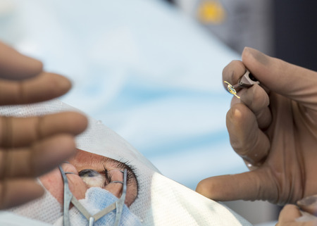 Lasik - laser correction for vision - ophthalmology surgery for eyesの写真素材