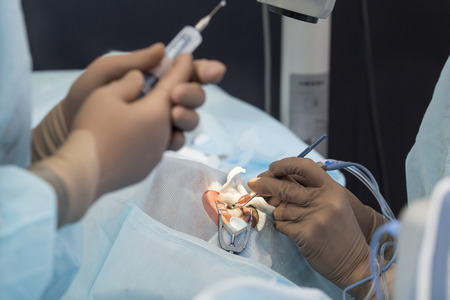 Phacoemulsification, destruction of the opaque lens by ultrasound, ophthalmic eye surgery. eye lens replacement, intraocular lens installation, surgical cataract treatment in Russia in Ulan-Ude.の写真素材