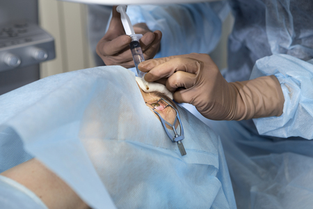 Laser surgery for vision correction and cataract removalの写真素材