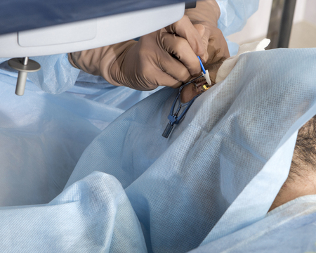 Laser surgery for vision correction and cataract removalの写真素材