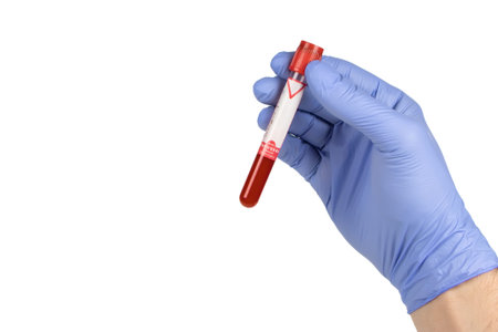 Hand holding test tube with blood plasma ready for testing.