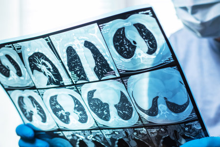 Doctor attentively examines the MRI scan of the patientの写真素材