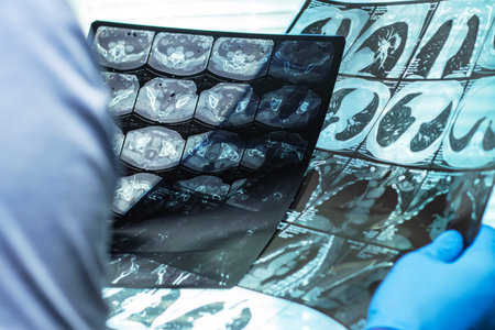 Doctor in mask examines and compares two MRI scans.の写真素材
