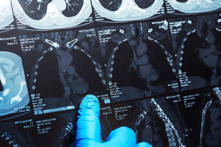Doctor attentively examines the MRI scan of the patient
